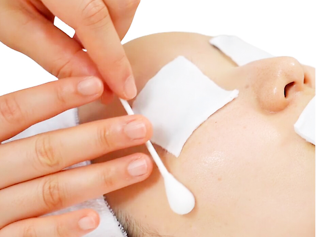 施術ピーリング